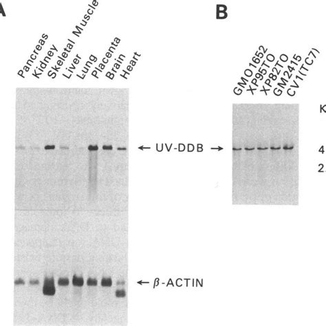 Chromosomal Localization Of The Human Uv Ddb Gene Agarose Gel