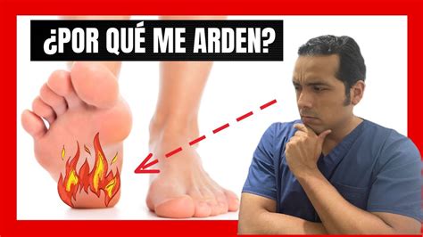 Por Qu Me Arden Los Pies Youtube