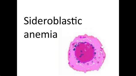 Sideroblastic Anemia Youtube