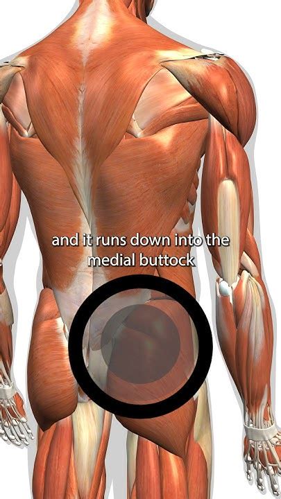 Gluteus Medius Trigger Points Youtube