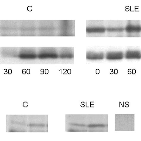 Representative Western Blot Analysis Of Serum Panel A And