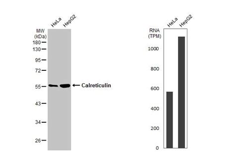 Calreticulin Recombinant Monoclonal Antibody Hl2057 Ma5 47272