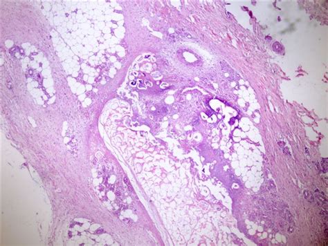 Saponification Histology