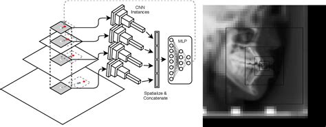 Figure 1 from Locating Cephalometric X-Ray Landmarks with Foveated ...