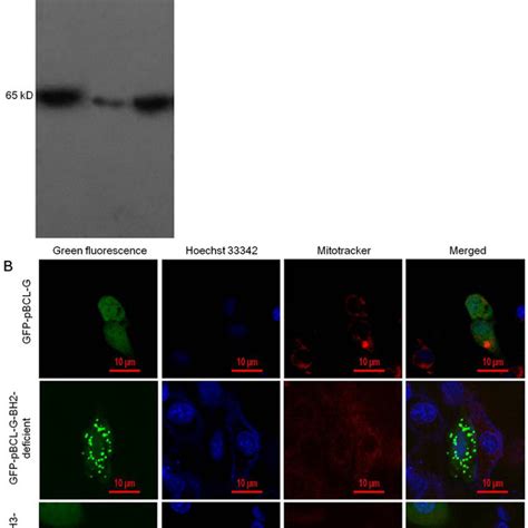 Detection Of The Expression And Subcellular Localization Of Gfp Fused