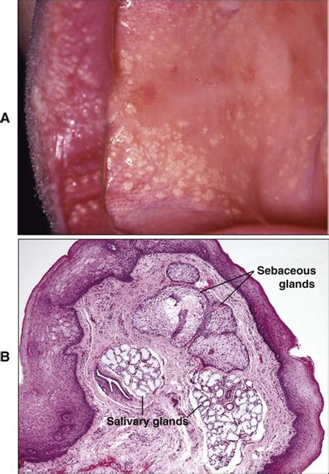 Alveolar Mucosa Histology