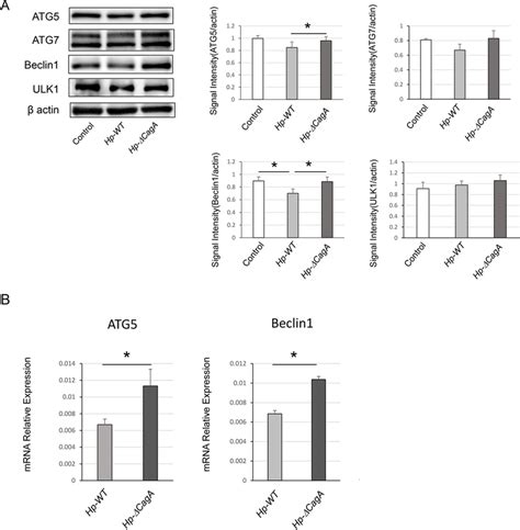 MRNA Expression And Protein Levels Of Autophagic Core Proteins In AGS