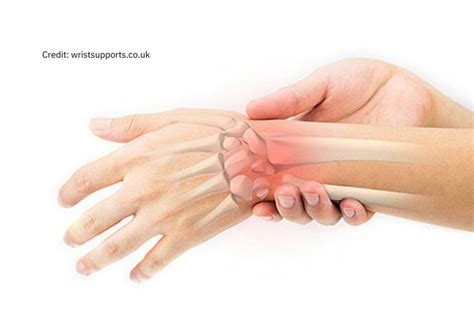 Types Of Wrist Injuries Ladan Hajipour Wrist And Hand Surgeon