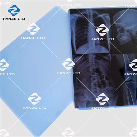 Inkjet Printing X Ray Medical Dry Laser X Ray Imaging Film For Medial