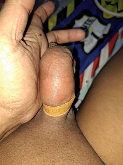 Myanmar Gay Saline Injection Photo Boyfriendtv