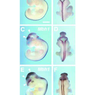 Mbh Expression In Mouse Embryos Lateral A C E And Dorsal B D F