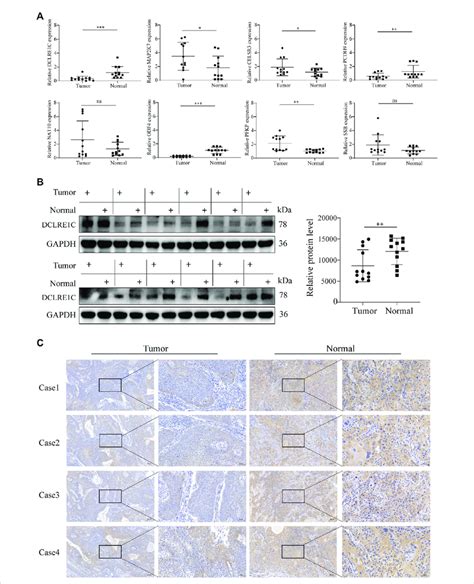 Detection Of Gene Expression In Tissue Samples Using Qrt Pcr Wb And