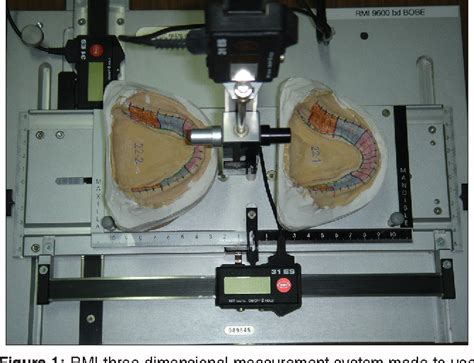 Pdf Effects Of Tongue Movements On Lingual Sulcus Depth While Border