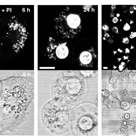 Apoptotic Morphology Of 143B TK Cells After Photosensitisation With