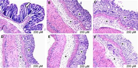 Representative Histological Micrographs Of Colonic Tissue Sections Download Scientific Diagram