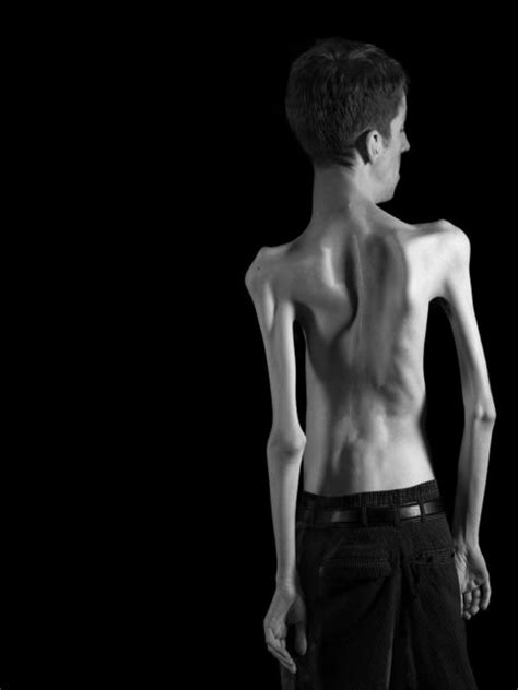'Impaired Perceptions': Photographer rejects first impressions | CNN