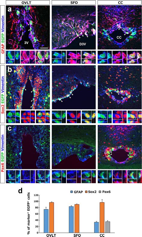 Expression Profile Of Nsc Marker Proteins In Egfp Tanycyte Like