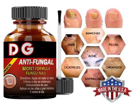 Anti Fungal Treatment Extra Strength Toenail Fungus Athletes Foot Fungi