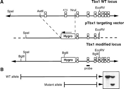 TBX1 Is Responsible For Cardiovascular Defects In Velo Cardio Facial