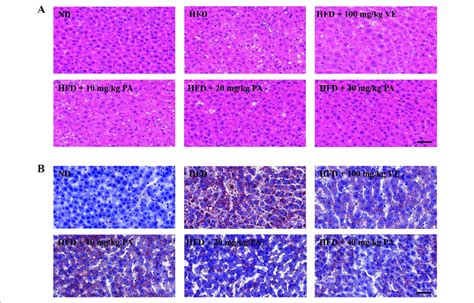 Pa Treatment Attenuated Hfd Induced Hepatic Steatosis In Rats A