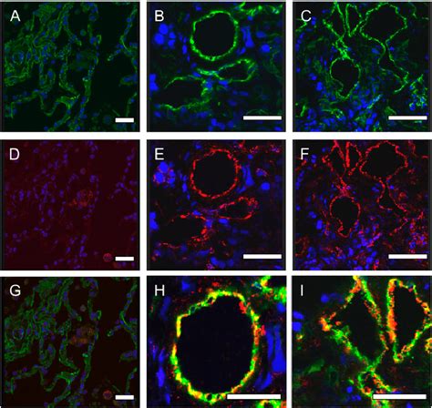 Representative Photomicrographs Of Confocal Immunofluorescence Staining