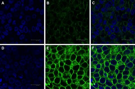 Confocal Microscopy Images Of Caco Cells Following Incubation With