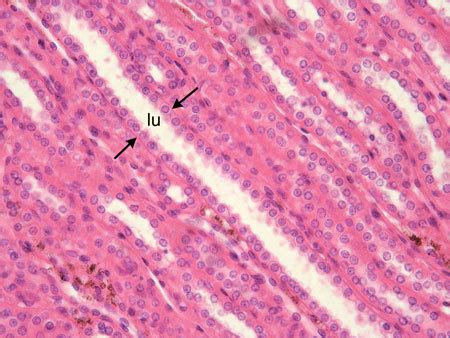 Simple cuboidal epithelium