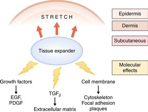 Tissue Expansion Plastic Surgery Key