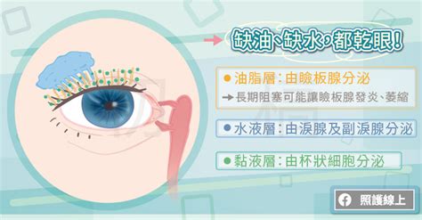 眼睛乾澀好疲勞，乾眼症檢測、保養懶人包