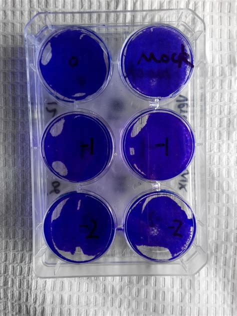 Vero Cells Transfection Protocol Of Adherent Vero Cells 96 Well