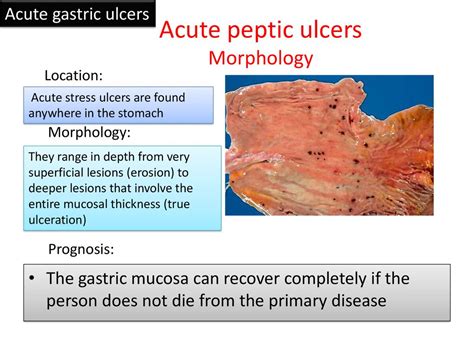 Dr Maha Arafah Dr Ahmed Al Humaidi Ppt Download