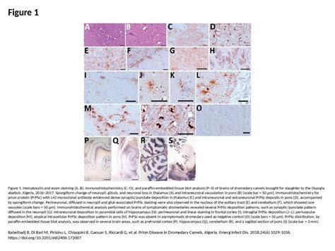 Ppt Figure 1 Figure 1 Hematoxylin And Eosin Staining A B