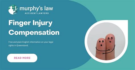 Finger Injury Compensation Loss Of Finger Murphys Law