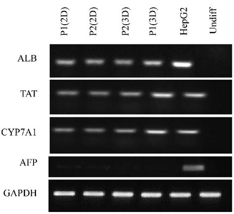 Hepatic Gene Expression Rt Pcr Analysis Of Liver Specific Gene