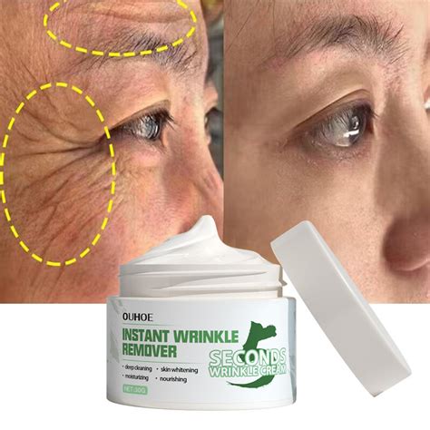 Wrinkle Removal Cream Online | cityofclovis.org