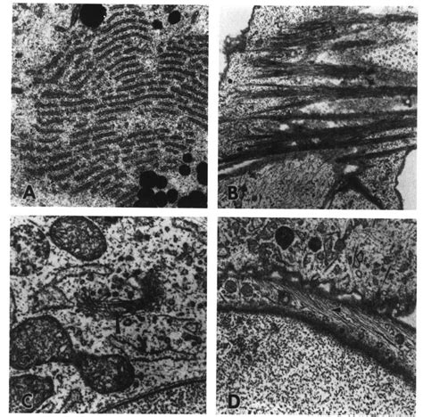 Transmission Electron Micrograph Of Human Sertoli Cells In Culture A