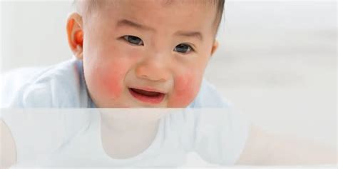 Preventing Food Allergies in Babies: Key Tips | SuperBottoms