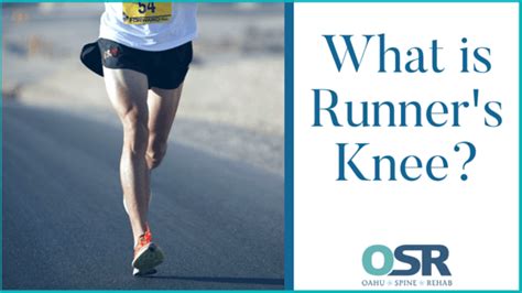 Runners Knee Revealed 1 Oahu Spine And Rehab