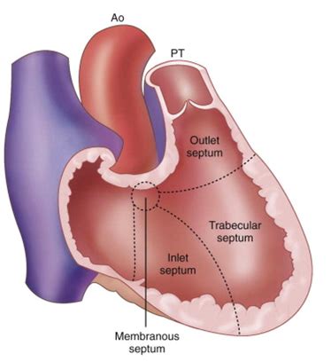 Ventricular septum anatomy - wikidoc