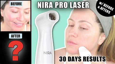 NIRA PRO LASER 30 DAYS RESULTS BEFORE AFTERS TIPS FOR BETTER