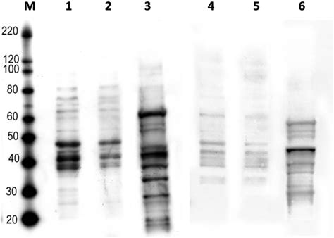 Scientists report for the first time that histones can be modified via ... 