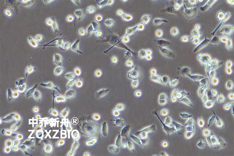 Mda Mb 231 Luc细胞 示踪细胞 人乳腺癌细胞 荧光素酶标记 上海中乔新舟生物科技有限公司