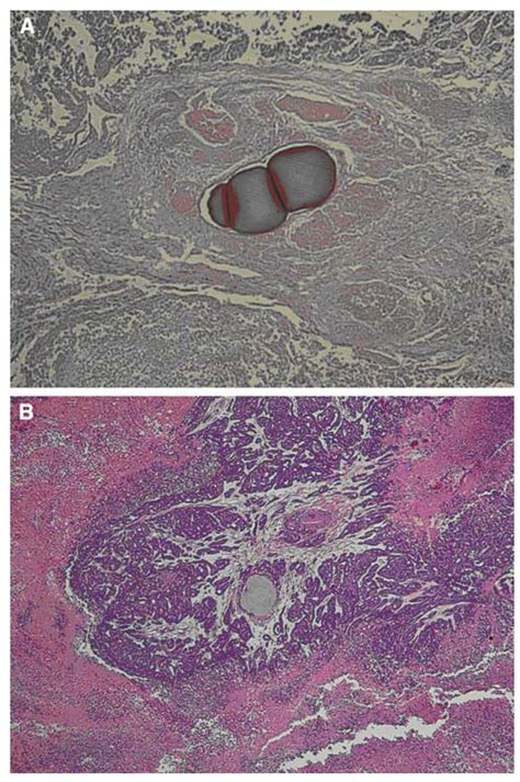 Pathologic images obtained at 7 days after treatment according to the ...