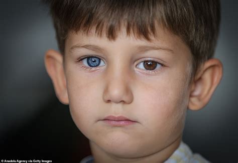 Brothers Are Born With Stunning Different Coloured Eyes Daily Mail Online