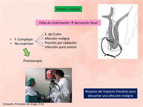 Abscesos Fistulas Anorectales Enfermedad Pilonidal Ppt