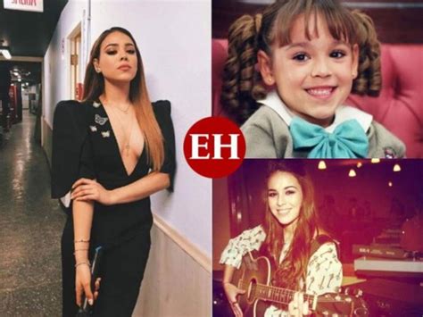 Danna Paola Nariz Antes Y Despues