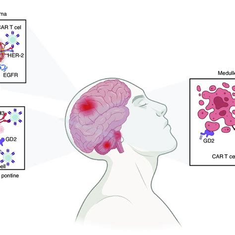 Summary Of The Current Chimeric Antigen Receptor T Cell Therapy Download Scientific Diagram