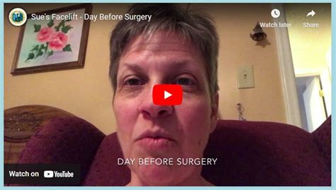 Sue’s Facelift – Day Before Surgery (Video)