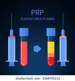 Prp Procedure Steps Vector Infographics Test Stock Vector Royalty Free