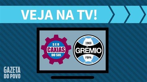 Caxias X Gr Mio Ao Vivo Saiba Como Assistir Ao Jogo Na Tv